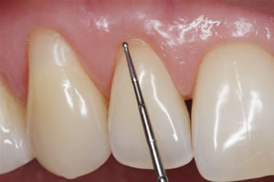 periodontologia lublin